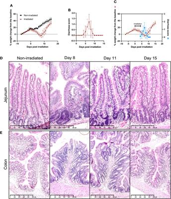 Compound Kushen injection reduces severity of radiation-induced gastrointestinal mucositis in rats